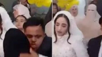 العروس قاصر.. تفاصيل جديدة في واقعة زواج عريس متلازمة داون