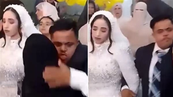 حبس والدي عروسين في الشرقية بعد تداول فيديو زفاف “متلازمة داون”| تفاصيل