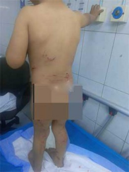 فيديو لـ”طفل جريح” يلهب النقاش مجددا.. “هل الكلاب الضالة أغلى ما نملك في الأردن؟”.. الضحايا في تزايد والحكومة صامتة