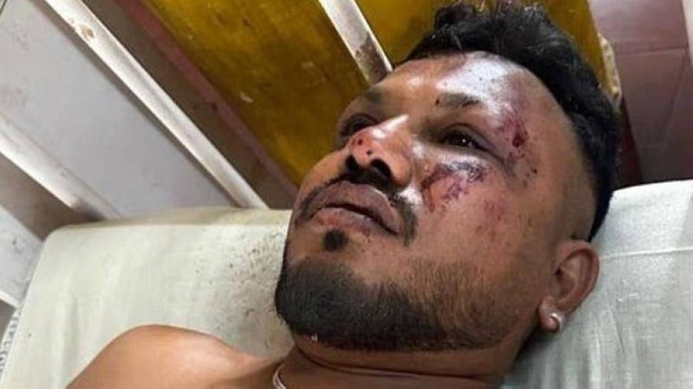 الناجي الوحيد.. «راميش» يروي للعالم تفاصيل كارثة الطائرة الهندية – أخبار السعودية
