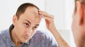 وداعاً للصلع.. اكتشاف علاج لتساقط الشعر باستخدام الخلايا الجذعية – أخبار السعودية