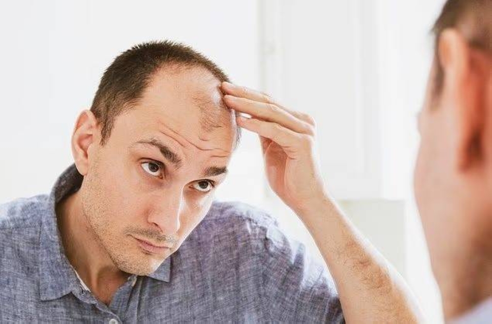 وداعاً للصلع.. اكتشاف علاج لتساقط الشعر باستخدام الخلايا الجذعية – أخبار السعودية
