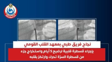 معهد القلب ينجح في إجراء قسطرة قلبية لرضيع 5 أيام